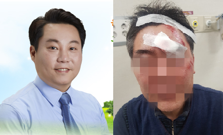 최재성 더불어민주당 강북구의회 의원(좌)과 그에게 폭행당한 번1동 동장 조모 씨(우).
