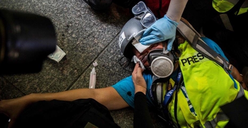 경찰이 쏜 고무탄에 맞아 오른쪽 눈이 실명한 인도네시아 여기자[사진-연합뉴스]