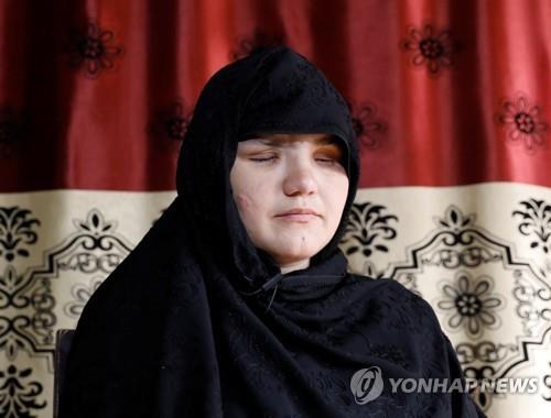 직업을 가졌다는 이유로 아버지의 사주를 받은 탈레반 괴한들로부터 두 눈을 공격받아 실명하게 된 아프가니스탄 여성 카테라(33). 카테라는 경찰이 된 지 3개월 만에 끔찍한 범죄 피해를 입고 현재 치료를 받고 있다. 사진은 지난 10월 12일 수도 카불에서 인터뷰하는 모습. (로이터=연합뉴스)