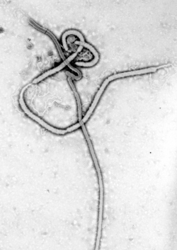 에볼라바이러스의 모습.(이미지=위키피디아)