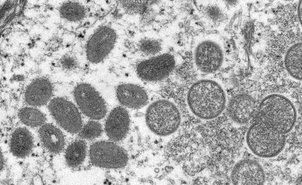 원숭이두창 바이러스을 전자현미경으로 관찰한 모습.(사진=로이터)